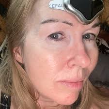 Learn More About The Trusted Treatment For Migraine