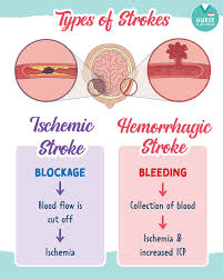 Bildergebnis für CVA