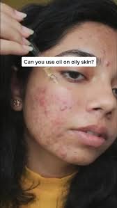 Aceite De Argan En La Cara