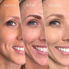 claudia mast (claudiamast)