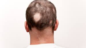 How does emu oil help hair grow? Hair Care Information Hope Beauty
