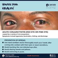 Image result for Acute Red Eye