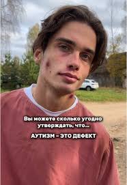 Нейроотличие