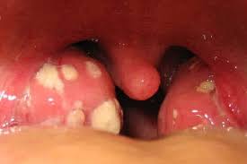 We did not find results for: 7 Gambar Radang Tenggorokan Yang Berbahaya