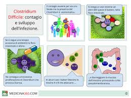 Symptoms include watery diarrhea, fever, nausea, and abdominal pain. Clostridium Difficile Terapia Trasmissione Sintomi Diagnosi E Dieta