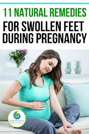 Pin On Natural Home Remedies