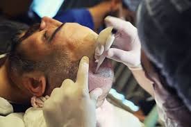 Signing out of account, standby. Prurito Post Trapianto Capelli C E Da Preoccuparsi Elithair