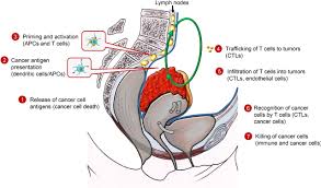 Epithelial cells, germ cells, and stromal. Immunotherapy In Ovarian Cancer Fake News Or The Real Deal International Journal Of Gynecologic Cancer