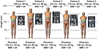 A Novel Method To Extend A Partial Body Ct For The Reconstruction Of Dose To Organs Beyond The Scan Range Ionut emilian moldovan, muscle flexing , cutting. extend a partial body ct