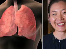 Many women 'unaware' of lung cancer risk