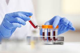 تحاليل أساسية وتحاليل العناصر النادرة للمواد اأولية اأكسيدية والمواد اأخرى crb analyse service gmbh. ØªØ­Ù„ÙŠÙ„ Crp Ø§Ù„Ù†Ø³Ø¨Ø© Ø§Ù„Ø·Ø¨ÙŠØ¹ÙŠØ© ÙˆØ¹Ù„ÙŠ Ù…Ø§Ø°Ø§ ÙŠØ¯Ù„ Ø§Ø±ØªÙØ§Ø¹ ØªØ­Ù„ÙŠÙ„ Crp ØªØ¬Ø±Ø¨ØªÙŠ