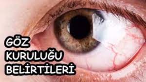 Goz Kurulugu Belirtileri Youtube