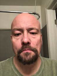 Jason Bingham Medical Updates