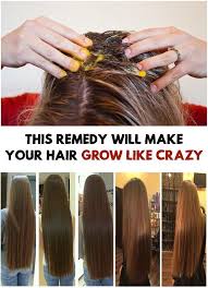 How can you grow hair faster if you're losing too much hair? This Remedy Will Make Your Hair Grow Like Crazy Hairremoval This Remedy Will Make Your Hair Grow Like C Ways To Grow Hair Help Hair Grow Make Hair Grow Faster