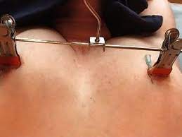 BDSM Nippel Torture Needles Nadeln - hotntubes.com