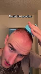 The Double Life of The True Hiriass