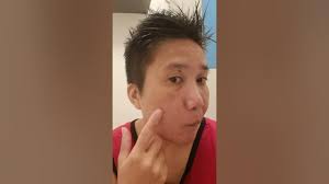 Super effective pala sa anti melasma legit