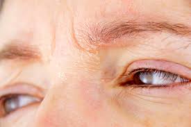 Eyebrow slits cycle in an out of popularity on a regular basis. Itchy Eyebrows What Does It Mean