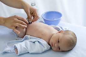 Quais As Principais Duvidas Sobre Umbigo De Bebe Cuidados E Prevencao