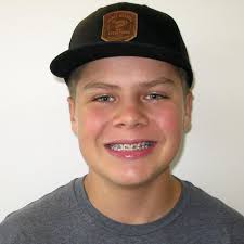 Michael J. Fillman, DDS, MS (@fillmansmiles) • Instagram photos and videos