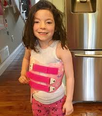 Orthopedic Issues And Prader Willi Syndrome Q A With Dr Van Bosse