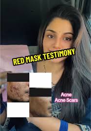 Bushelelezi Skincare Testimonies