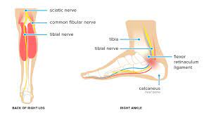 Tarsal Tunnel Syndrome Symptoms Causes And Treatments