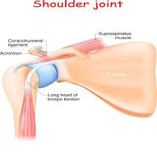 Download scientific diagram | the shoulder pain and disability index (spadi). What S Causing Your Shoulder Pain Petersen Physical Therapy