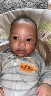 ANONYMOUS POST: My 11 month old daughter who is breastfed has this raised  rash come up