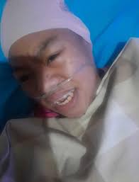 My Daughter's Fight with Microcephaly