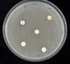 Ph, cation concentration, and thymidine contents) are well maintained. Mueller Hinton Agar Media With Antibiotic Sensitive Disc Showing Download Scientific Diagram