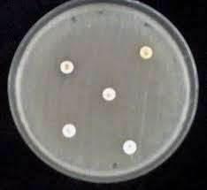 Are contained in supplemental tables.5 these documents should be Mueller Hinton Agar Media With Antibiotic Sensitive Disc Showing Download Scientific Diagram