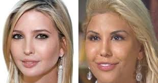 It appears she has reduced her gummy smile . Women Are Flocking To Plastic Surgeons To Look Like Ivanka Trump