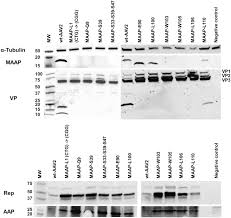 Image result for Black 1997 AAV