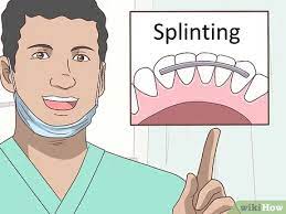 A metal splint and bonding are inserted to help stabilize the teeth. 3 Ways To Loosen A Tooth Wikihow