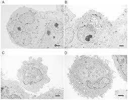 Maybe you would like to learn more about one of these? Electron Microscopic Analysis Of Different Cell Types In Human Pancreatic Cancer Spheres