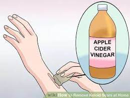 Pin On Diy Beauty Needs