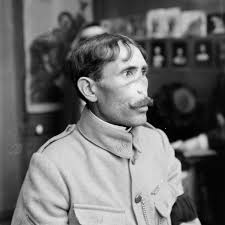 Anna C. Ladd and the Camouflaging of Mutilated Faces