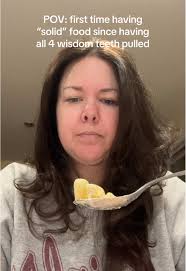 IMMEDIATE REGRET😭🦷 #fyp #macandcheese #macaroniandcheese #viral #walmart  #wisdomteeth #wisdomteethremoval #day6 #contentcreator