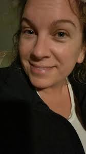 Does doctor Gulani do cataract surgery beyond shaping the crazy cornea?  Thanks