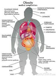 Pin By Christopher Holland On Gastric Sleeve Surgery Metabolic Syndrome Fatty Liver Disease Liver Disease