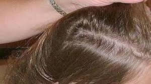 كيف يتم التخلص من القمل Long Hair Styles Lilac Hair