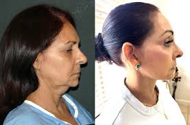 Andrew Jacono, MD, FACS (@drjacono) • Instagram photos and videos