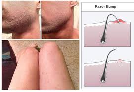 Pin On Skin Care