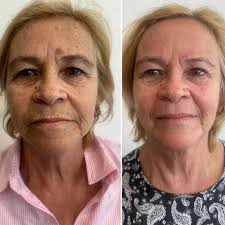 Joanne Astone (@joannemareebeautyspecialist) • Instagram photos and videos