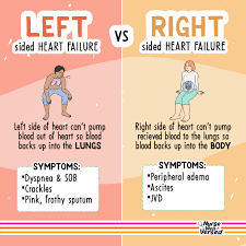Image result for Right Heart Failure
