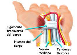 Sindrome Del Tunel Carpiano