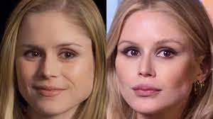 Erin moriarty before surgery