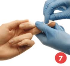 Image result for Capillary Puncture
