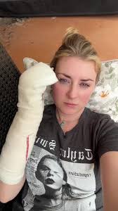 Sam Berryhill Hedge Trimmer Finger Injury Recovery Video